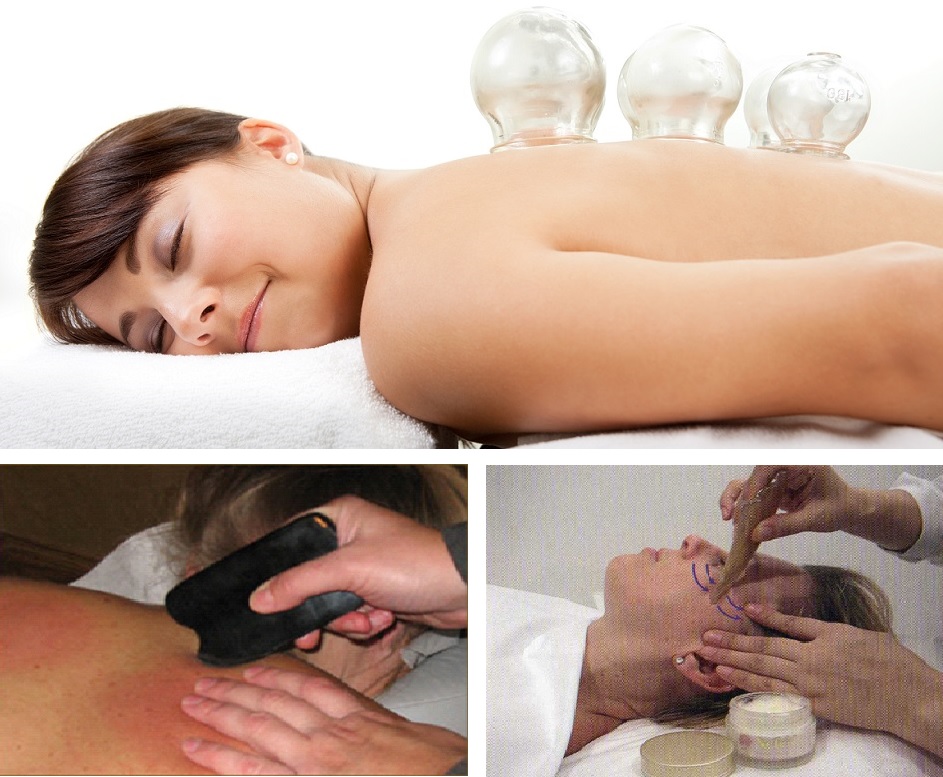 ventosas y gua-sha
